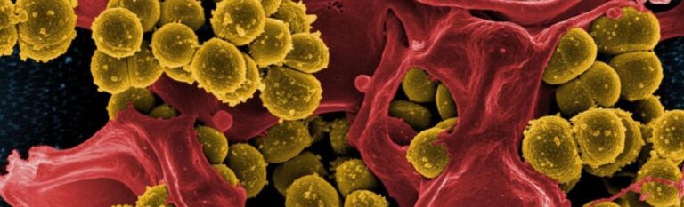 Pročitajte više o članku Helicobacter pylori – kako si pomoći na prirodan način?
