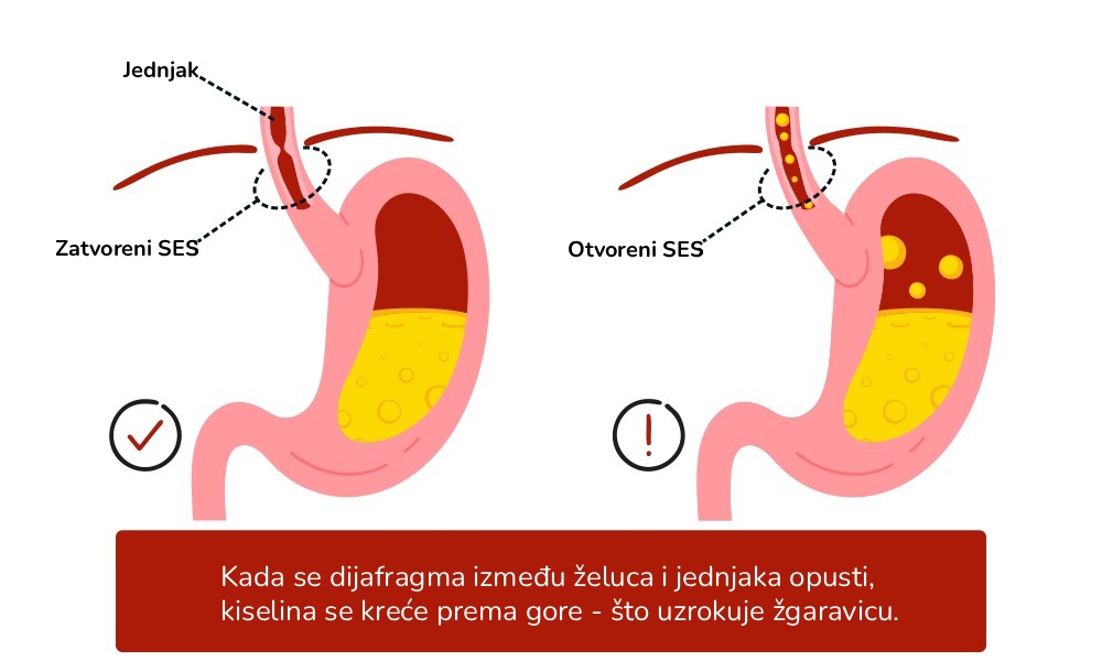 Mastika GERB Zgaga Delovanje Poziralnika HR